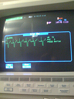 heart monitor