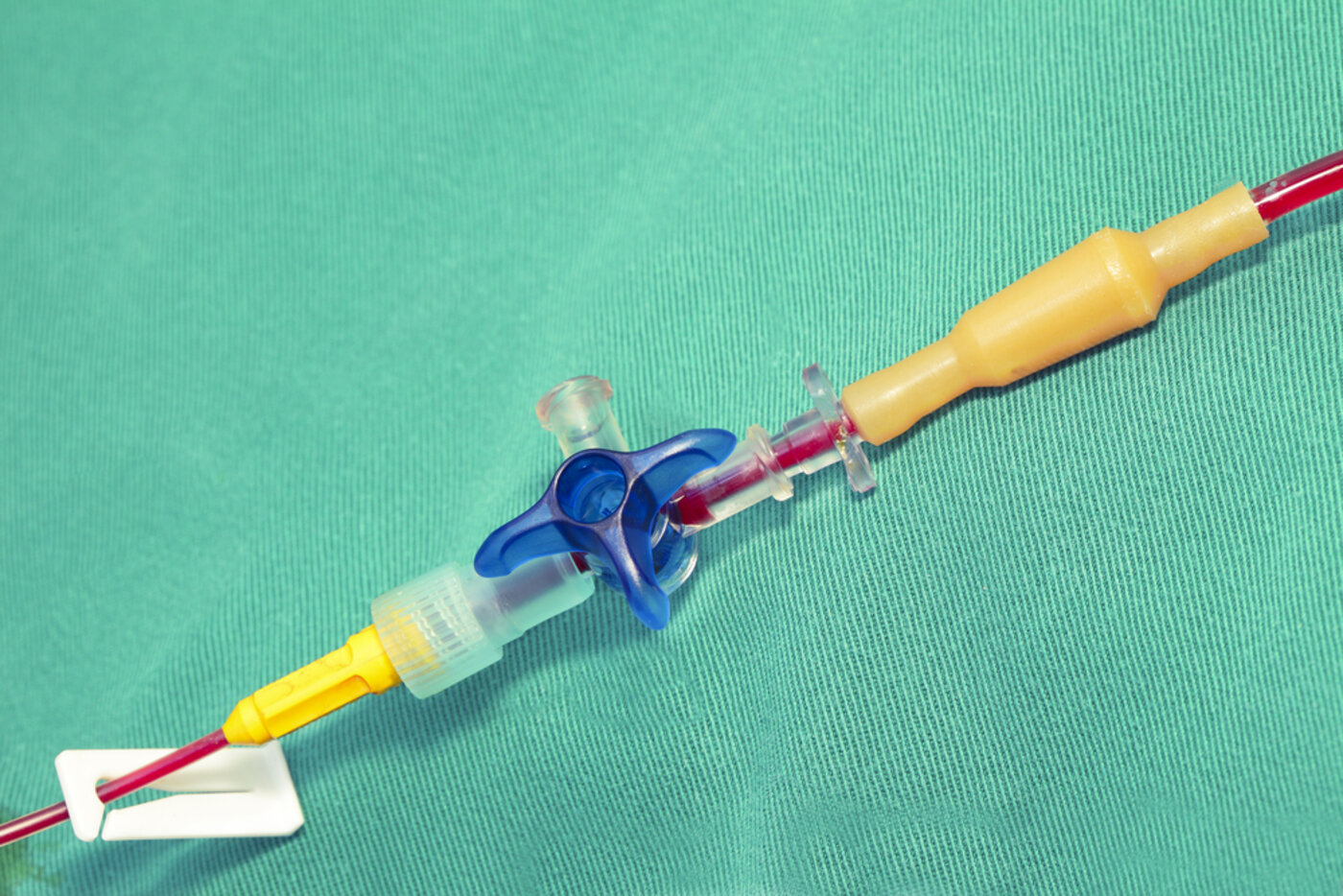 Medical tubing for IV fluid