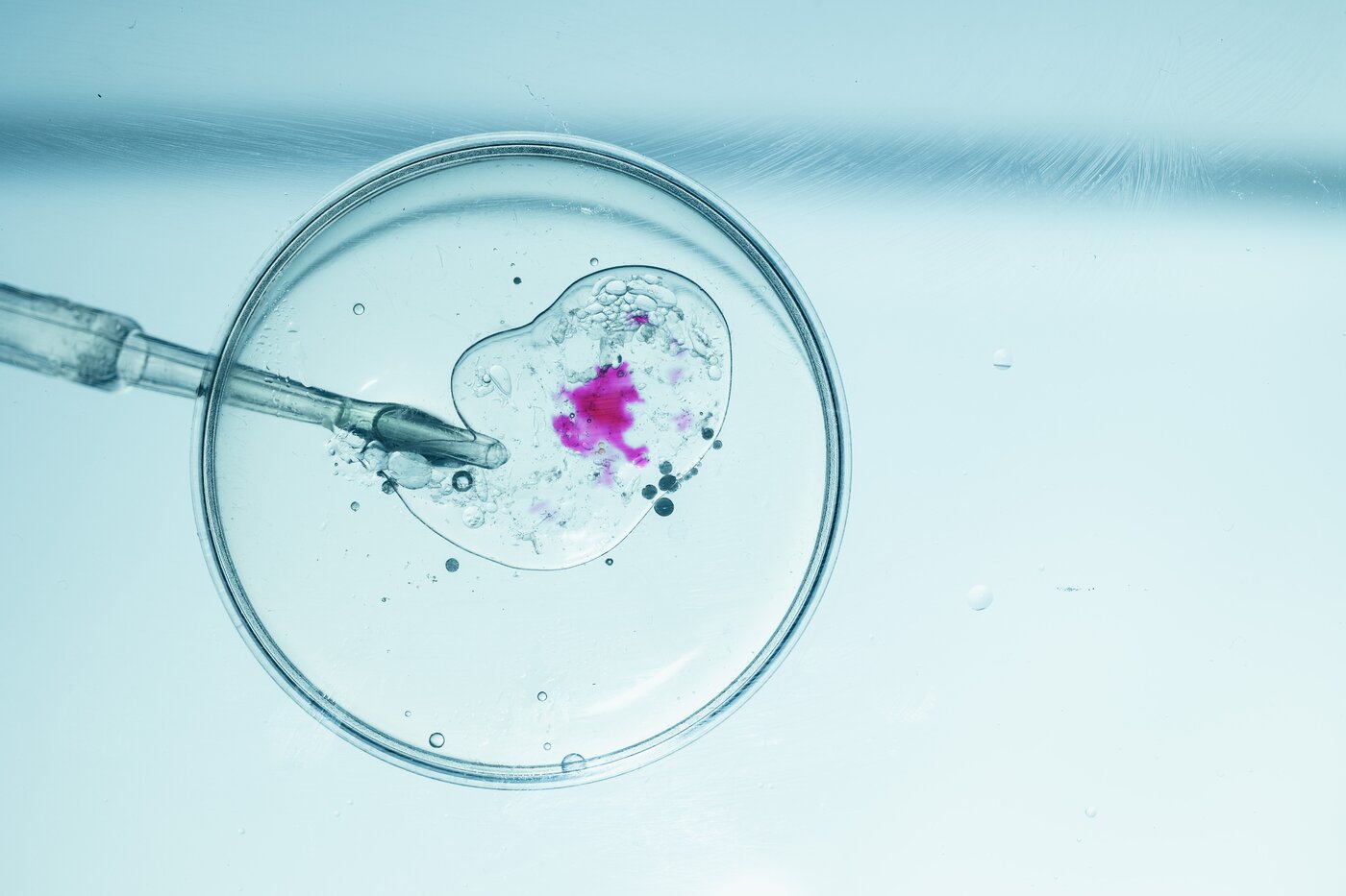 Petri dish with embryo sample in IVF laboratory